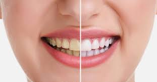 بهداشت دندان 2